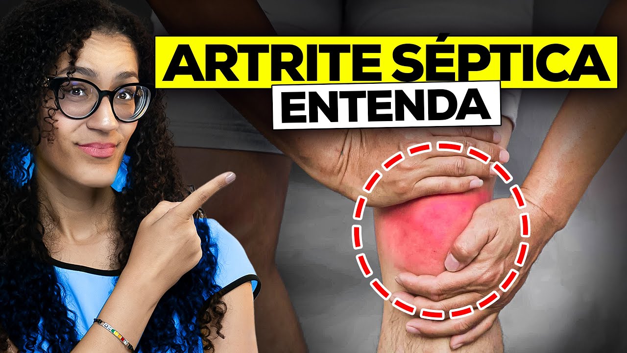 Artrite Séptica - Sintomas e Diagnóstico da Artrite Infecciosa