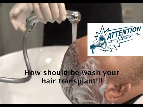 first wash after hair transplant at medicalaest