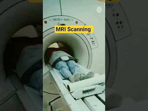 MRI Scan