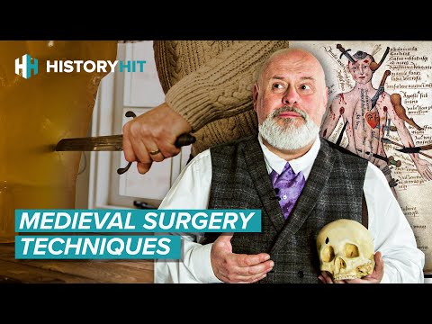 What Was Battlefield Surgery Like In The Medieval Period?