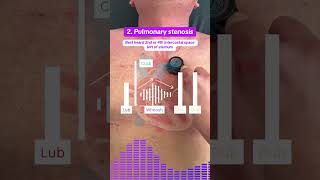 4 Abnormal Heart Sounds: Systolic Murmurs Explained #heartsounds #heartvalves