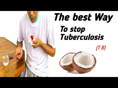 , title : 'how to treat Tuberculosis at home using the best natural remedy (TB)'