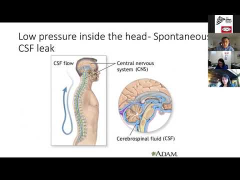 EDS ECHO Clinicians North America (CLN3A), Session 6