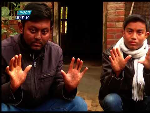 এক বিরল বংশগত সমস্যার কারণে দুই হাতের আঙ্গুলে কোনও ছাপ নেই