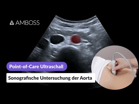 Point-of-care ultrasound (part 1/4): Sonographic examination of the aorta | AMBOSS