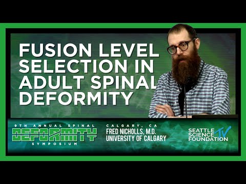 Fusion Level Selection in Adult Spinal Deformity - Fred Nicholls, M.D.