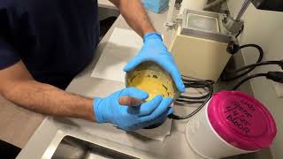 Pouring Alginate Impressions
