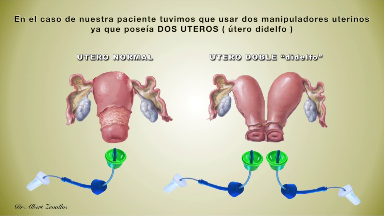Albert Zevallos Cardenas-16