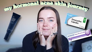 my hormonal acne skin journey | experience on doxycycline🌿🪐