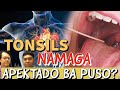TONSILS Namaga: Apektado ba PUSO? - Tips ni  Doc Gim Dimaguila (ENTDoctor) at Doc Willie Ong
