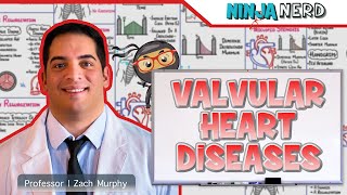 Valvular Heart Diseases | Clinical Medicine