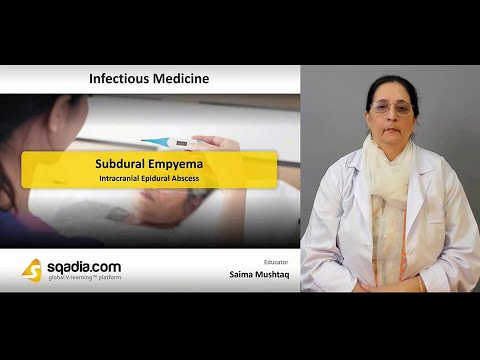 Subdural Empyema | Intracranial Epidural Abscess