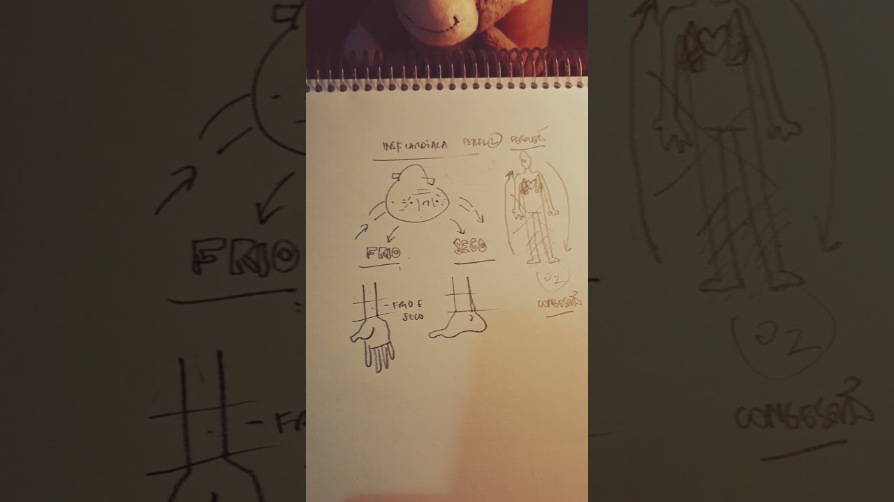 Atenção! Insuficiência cardíaca do tipo D é uma apresentação clinica incomum!