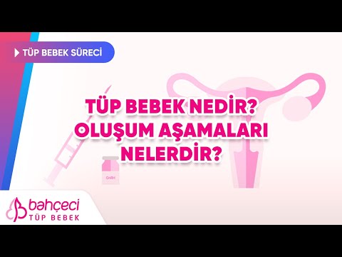 Tüp bebek nedir, aşamaları nelerdir ?