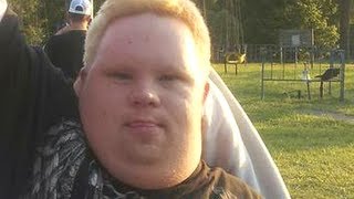 Man With Down Syndrome Killed Over A Movie Ticket | Police &amp; The Disabled