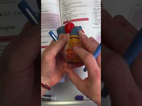 Angina vs Myocardial Infarction