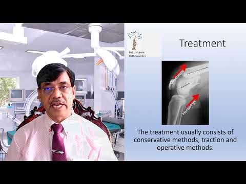 Let Us Learn Orthopaedics- Supracondylar Fracture Femur