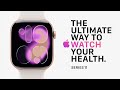 Смарт-годинник Apple Watch Series 11 GPS + Cellular 46mm Jet Black Alu. Case w. Black S. Band - M/L (MFC44) Купити в Україні