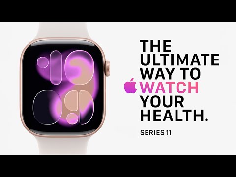 фото новые apple watch series 11 гарантия/подарки 0