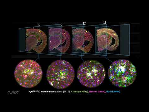 Application of Single Cell and Spatial Transcriptomics in ...