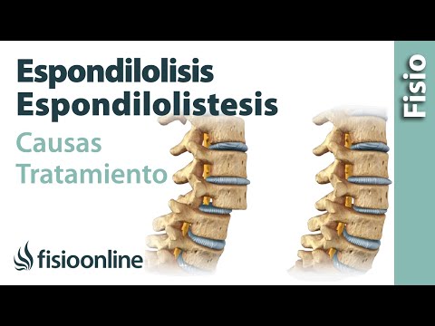 Pomate e pillole per le articolazioni delle mani Dolore alle articolazioni del ginocchio dopo il parto