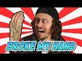 I BROKE MY HAND