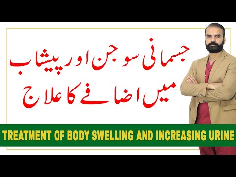 Treatment of Body Swelling and increasing urine ?Edema in Urdu Hindi?