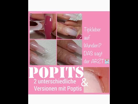 Rheumatismus des Knies bei Kindern Sie können Sport mit Bursitis des Kniegelenks spielen