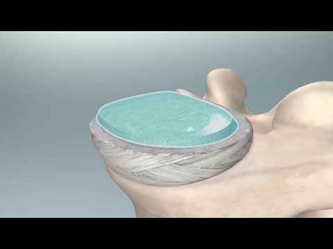 Come riparare tessuto cartilagineo del rachide cervicale Molto forti dolori alla schiena come trattare