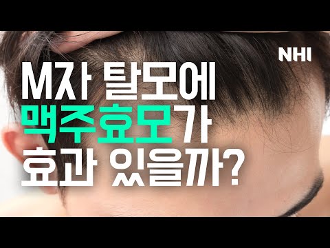 M자 탈모에 맥주효모가 정말 효과 있을까? #판시딜 #판토가 #케라민 #마이녹실ㅣ뉴헤어