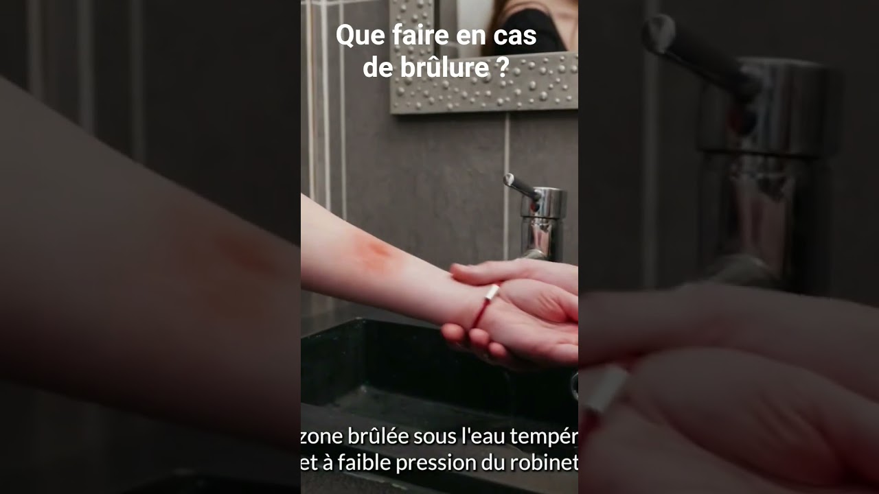 Que faire en cas de brûlure ? #shorts