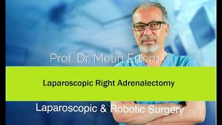 Miniaturka - Laparoscopic Right Adrenalectomy. Metin Ertem MD.FACS