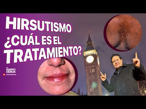 HIRSUTISMO: ¿CUÁL ES EL TRATAMIENTO?
