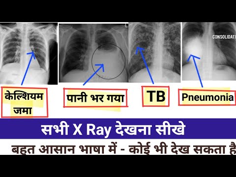 X Ray देखना बहुत आसान - अब X Ray कोई भी देख सकता है