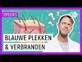 WAT GEBEURT ER MET JE HUID BIJ... | Vraag het dokter Elbert | NPO Zapp