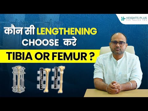 कौन सी Limb Lengthening सर्जरी चुने — Tibia या Femur?