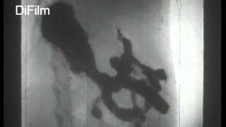 DiFilm - Los rayos X - Un film cultural de la UFA 1937