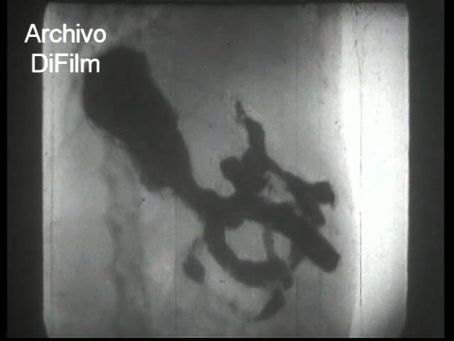 DiFilm - Los rayos X - Un film cultural de la UFA 1937