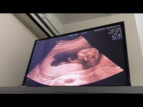 Pregnant 16 weeks ultrasound! Gender reveal!