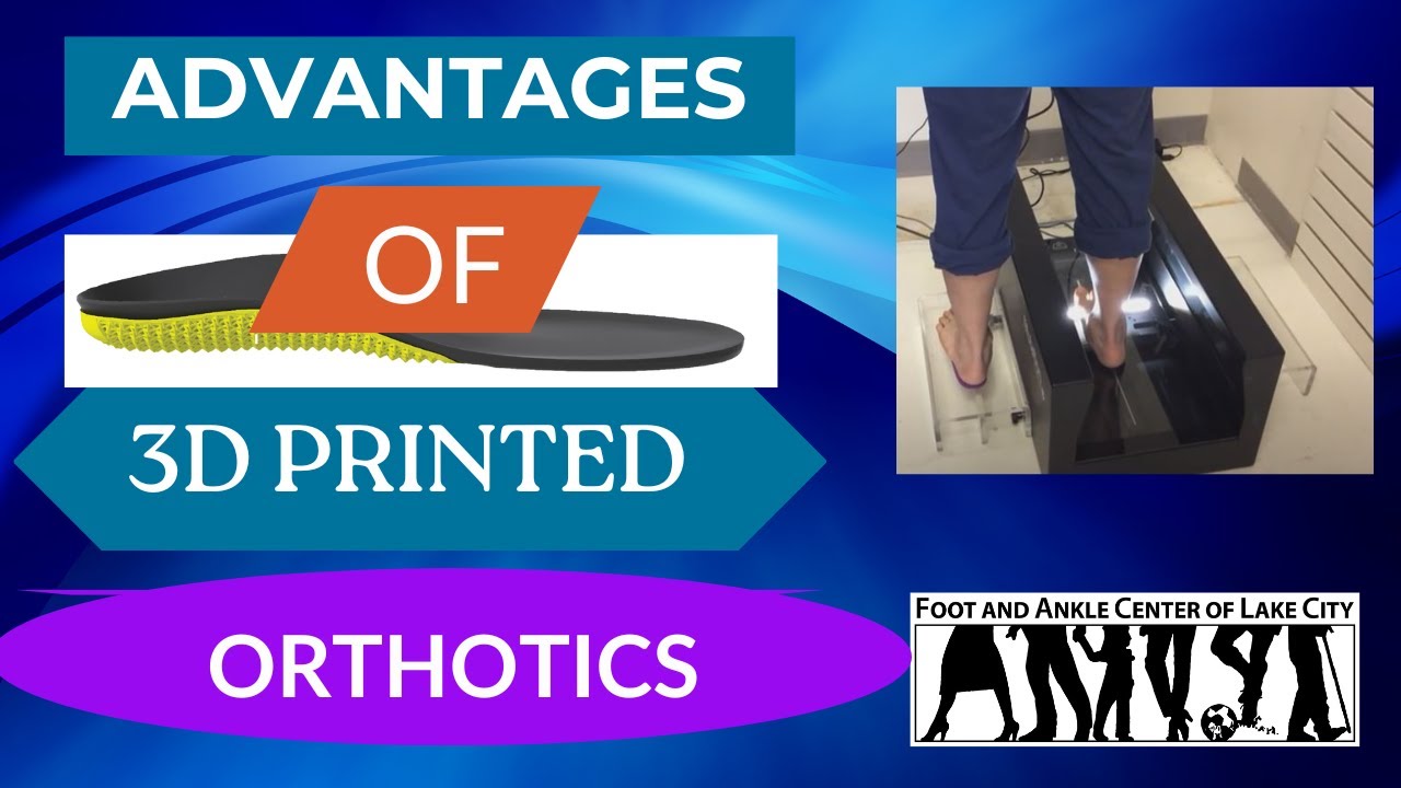 The Advantages of 3D Printed Orthotics | Foot and Ankle Center of Lake City