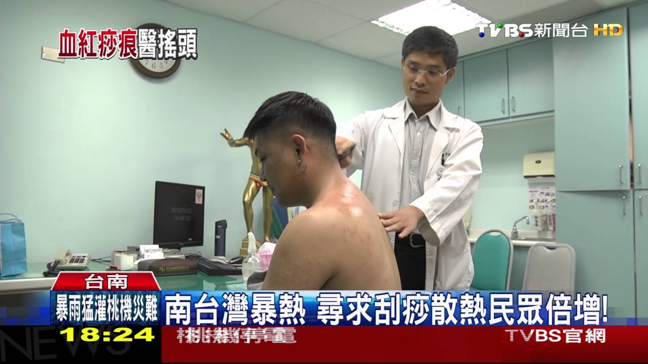 台灣「鯛」民？刮痧刮成生魚片PO網　傻眼