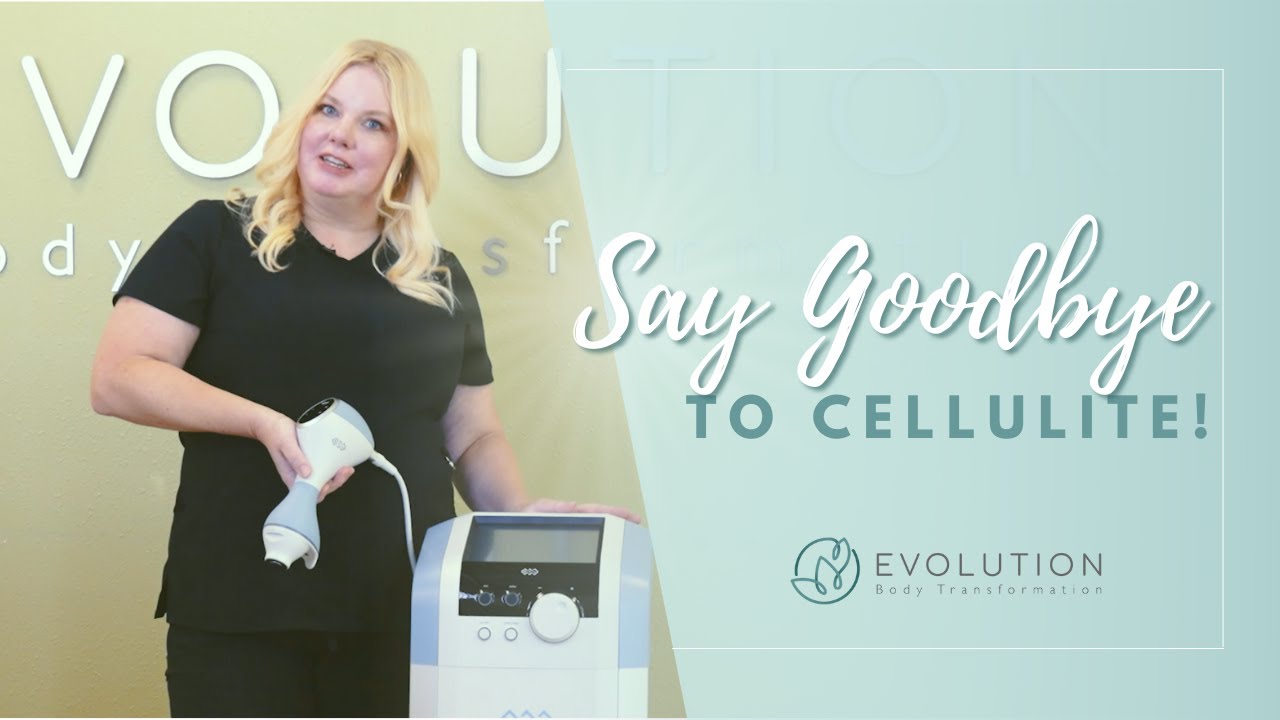 EMTONE AT EVOLUTION | How To Reduce CELLULITE