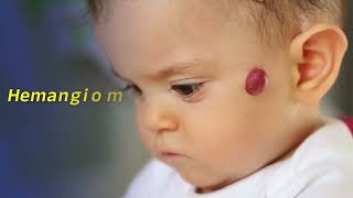 আপনার শরীরের তিল কখন দুশ্চিন্তার কারণ হতে পারে? Is it Mole- Nevus- or something else?