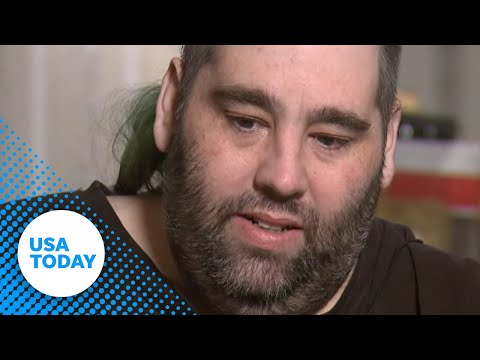 Man gets 100 pound growth removed from scrotum