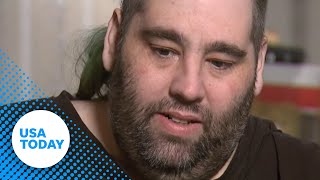 Man gets 100 pound growth removed from scrotum