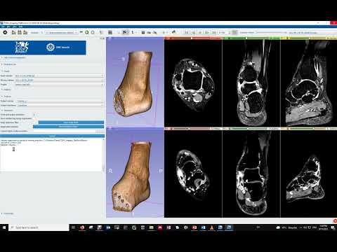 Standalone medical image analysis app based on Slicer