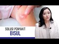 Boils Symptoms Causes And How To Treat Them Kata Dokter