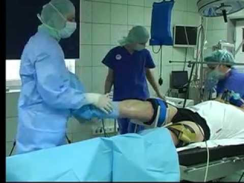 Wunden Hals Schulterblatt hinten rechts Krankheit der Schultergelenke ihrer Behandlung