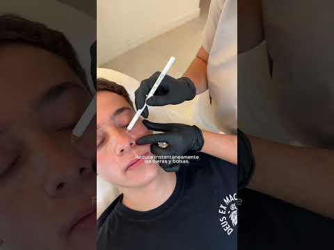 Santé Clínica Estética Barcelona