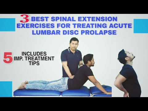 Low back pain due to stiff sacroiliac joint Try Pelvic drop home exercise for quick relief